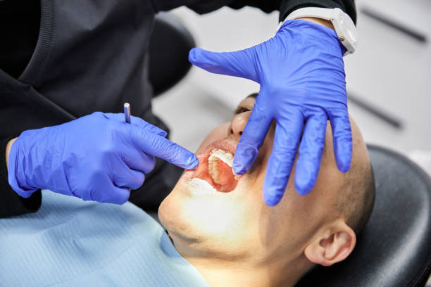 Best Emergency Dental Care for Sports Injuries in Mineral Wells, TX