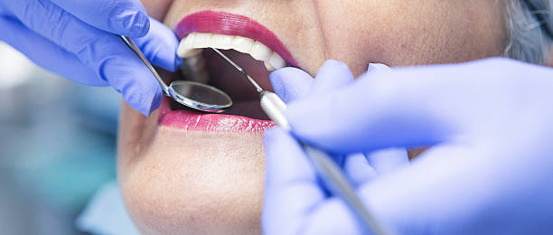 Best Emergency Care for Gum Disease in Mineral Wells, TX