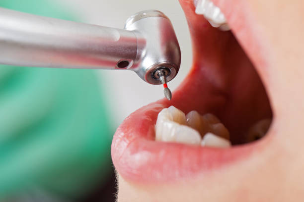 Best Emergency Cosmetic Dentistry (e.g., broken veneers) in Mineral Wells, TX